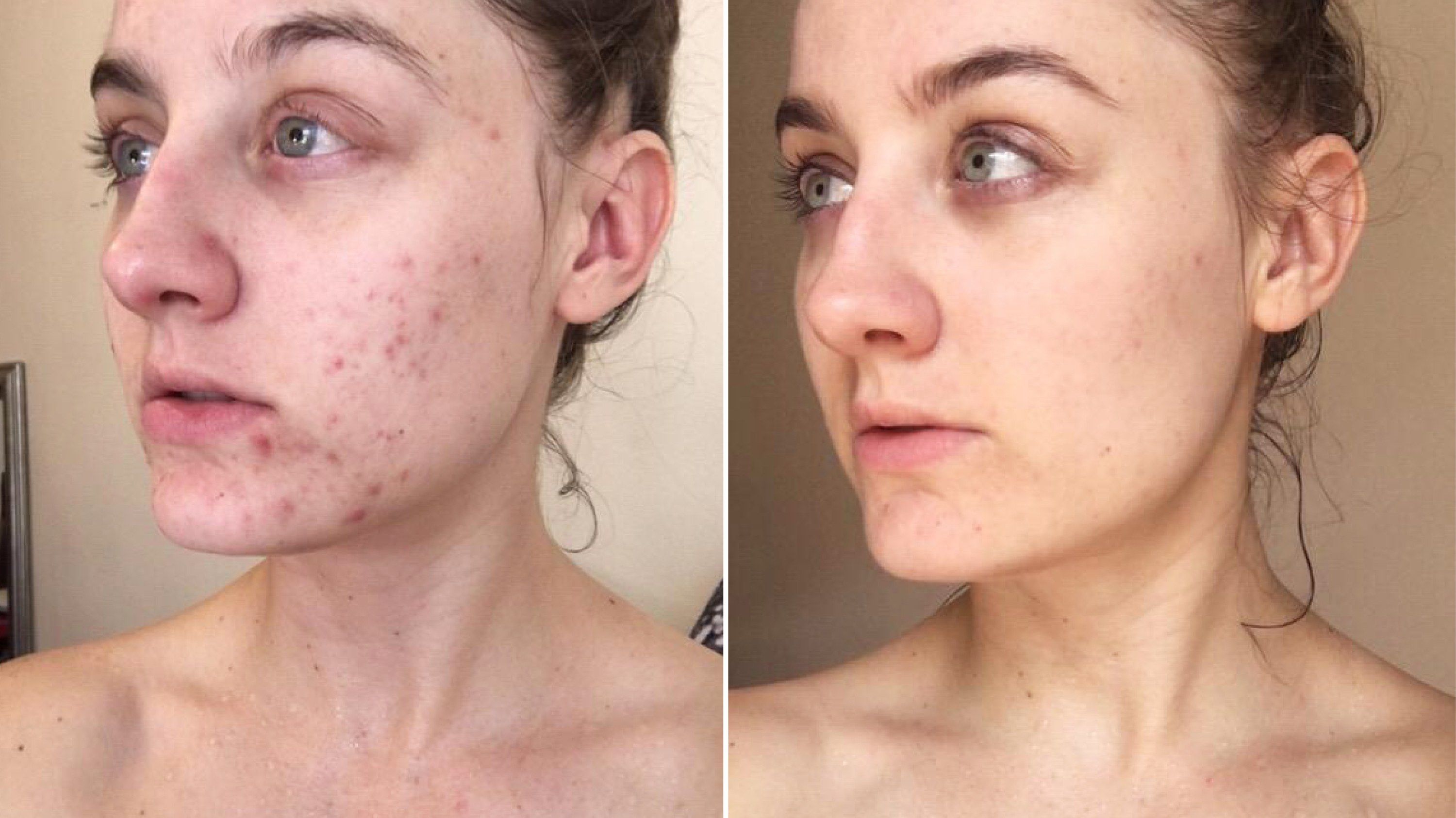 How to equalise your skin!